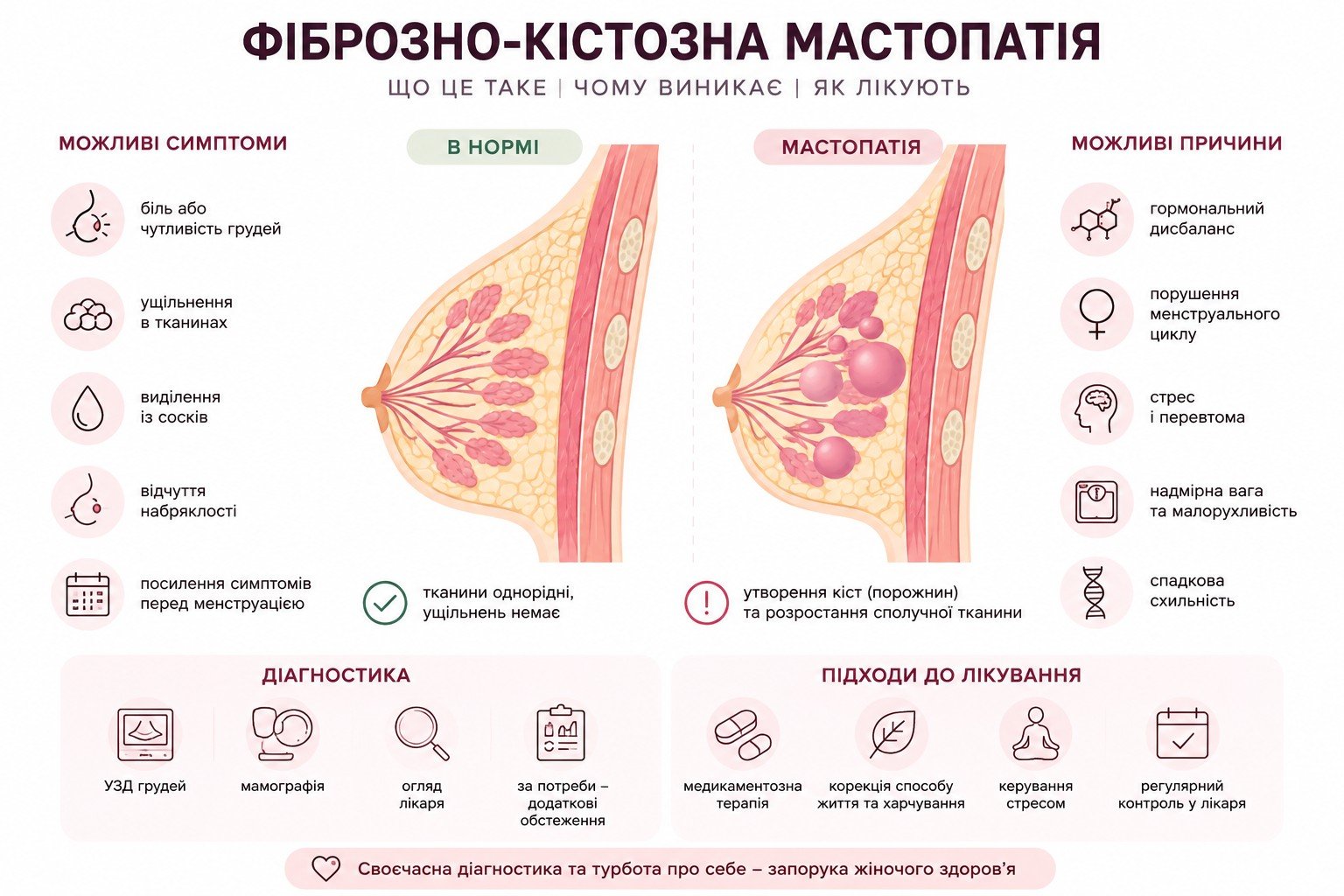 Գ������-������� ���������: �������, ���䳿, ���������� �� ������ �� ��������